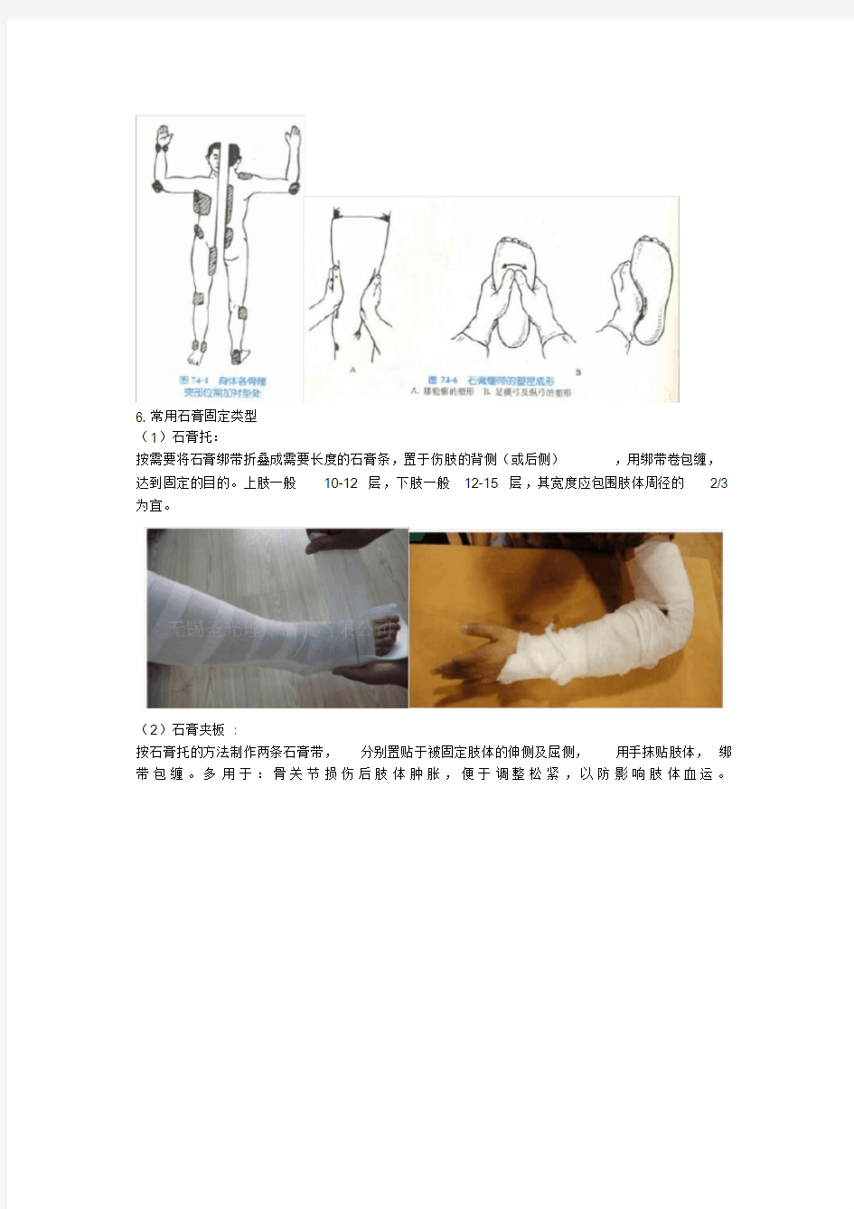 骨科基本操作之石膏固定技术