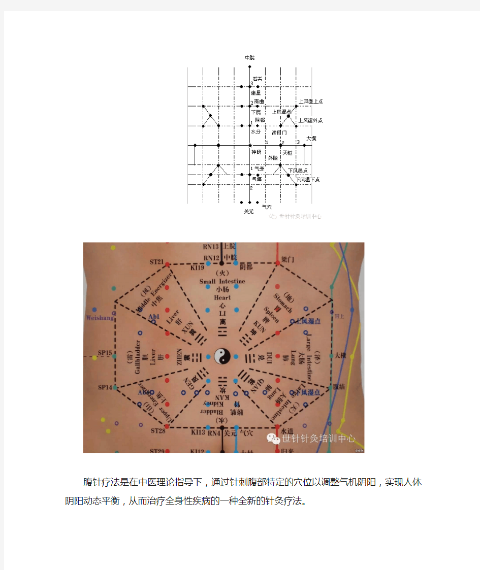 腹针疗法及16例常用处方